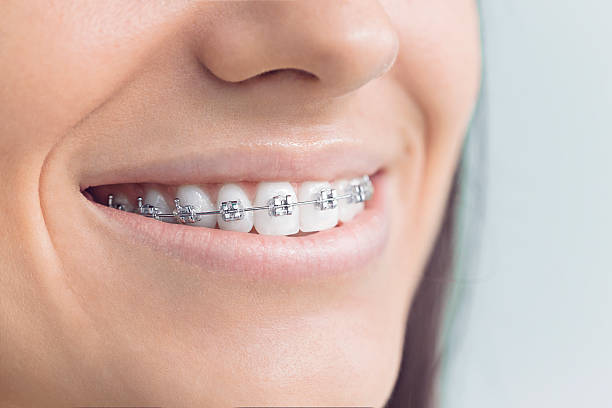 Best Sedation Dentistry  in Ke Providence, LA